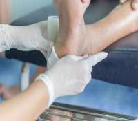 درمان زخم پای دیابتی چگونه است؟